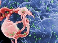Izrael zrejme vynašiel liek proti AIDS