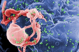 Izrael zrejme vynašiel liek proti AIDS